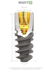 Root R All-In-One L18 d 3,5 x 18mm